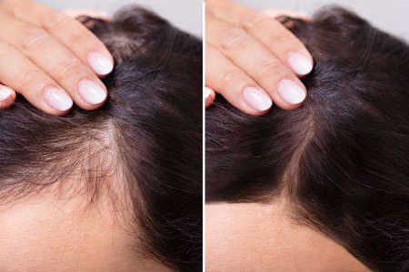 OUHOE - ELIXIR PARA CRECIMIENTO DE CABELLO