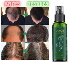 OUHOE - ELIXIR PARA CRECIMIENTO DE CABELLO