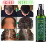 OUHOE - ELIXIR PARA CRECIMIENTO DE CABELLO